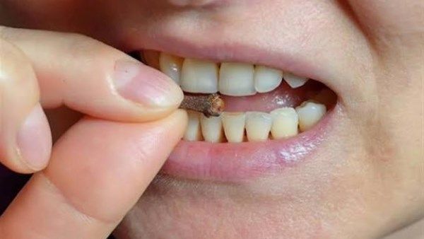 أبرز الفوائد الصحية لمضغ القرنفل يوميًا وكشف موقع