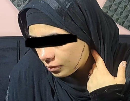 تأجيل محاكمة المتهمة بتشويه وجه «عروس مصر القديمة» تأجيل محاكمة المتهمة بتشويه وجه «عروس مصر القديمة»