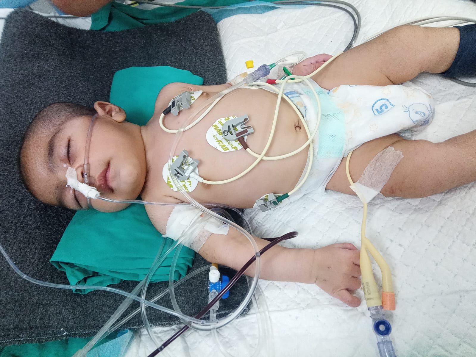 الرضيع فهد الجبرى يصارع الموت بخيام غزة بين البرد وضعف التجهيزات الطبية.. صور - الفجر سبورت