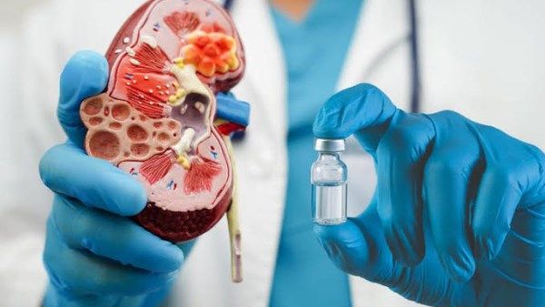 مشروبات شائعة ترفع خطر الفشل الكلوي… دراسة علمية تطلق تحذيرًا صريحًا - الفجر سبورت