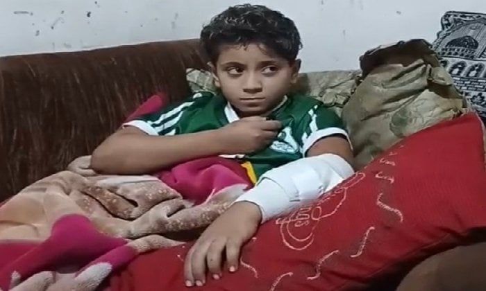 بعد عقره من كلب ضال.. تعليم بورسعيد توجه بتيسيرات وإجراءات خاصة للتلميذ آدم خلال امتحانات نصف العام - الفجر سبورت