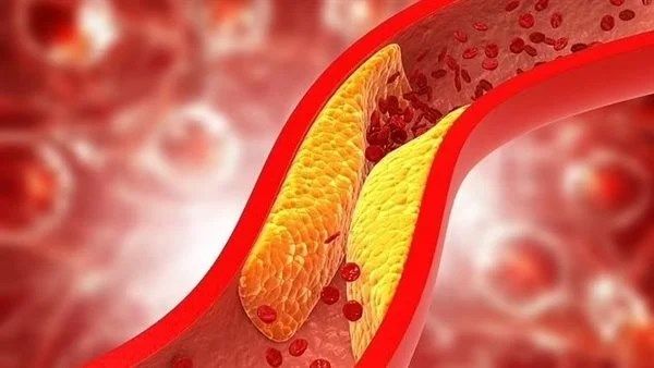 هل ترتفع مستويات الكوليسترول لديك؟.. عادة صباحية بسيطة السبب - الفجر سبورت