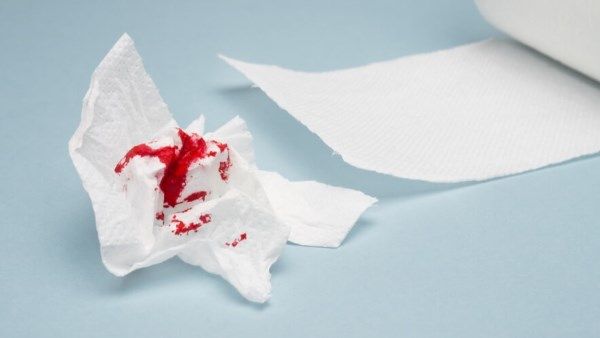النزيف المهبلي بعد سن اليأس .. ما أسبابه ومتى يكون مقلقًا؟ - الفجر سبورت