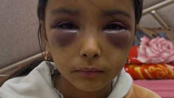 زوجة الأب تعتدي بالضرب المبرح على صغار زوجها.. والأمن يكشف الحقيقة - الفجر سبورت