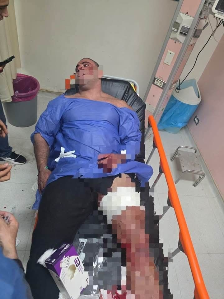 خناقة ورصاص ودمـ.ـاء.. القصة الكاملة لإطلاق بودي جارد الرصاص على مدير جولدن جيم بالشيخ زايد.. صور - الفجر سبورت