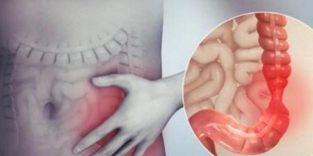 اضبط وزنك.. 3 عادات يومية تحميك من سرطان القولون - الفجر سبورت