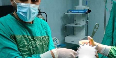 إنقاذ
      شاب
      يعاني
      من
      قرح
      وتآكل
      في
      مفصل
      الركبة
      بمستشفى
      قويسنا
      المركزي - الفجر سبورت