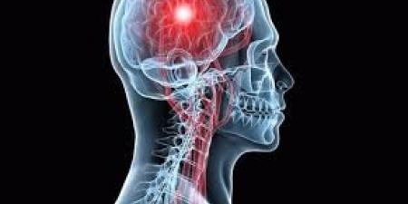 بعد انتشارها بين الشباب .. طرق الوقاية من السكتة الدماغية - الفجر سبورت