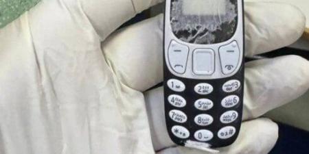 فريق طبي ينجح في استخراج هاتف محمول من بطن مريض ظل داخله 11 شهرا - الفجر سبورت