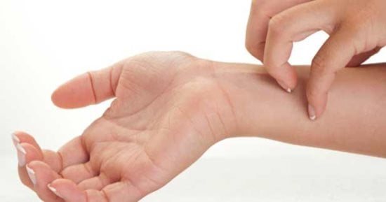 ابتكار غسول مصنوع من زيت الزيتون يعالج عدوى الجرب من أول استخدام