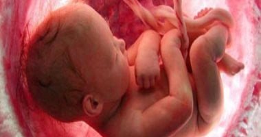 تقنية لفحص استعداد الأجنة للمرض تثير جدلا.. هل تجعل الطفل أقل عرضة للأمراض
