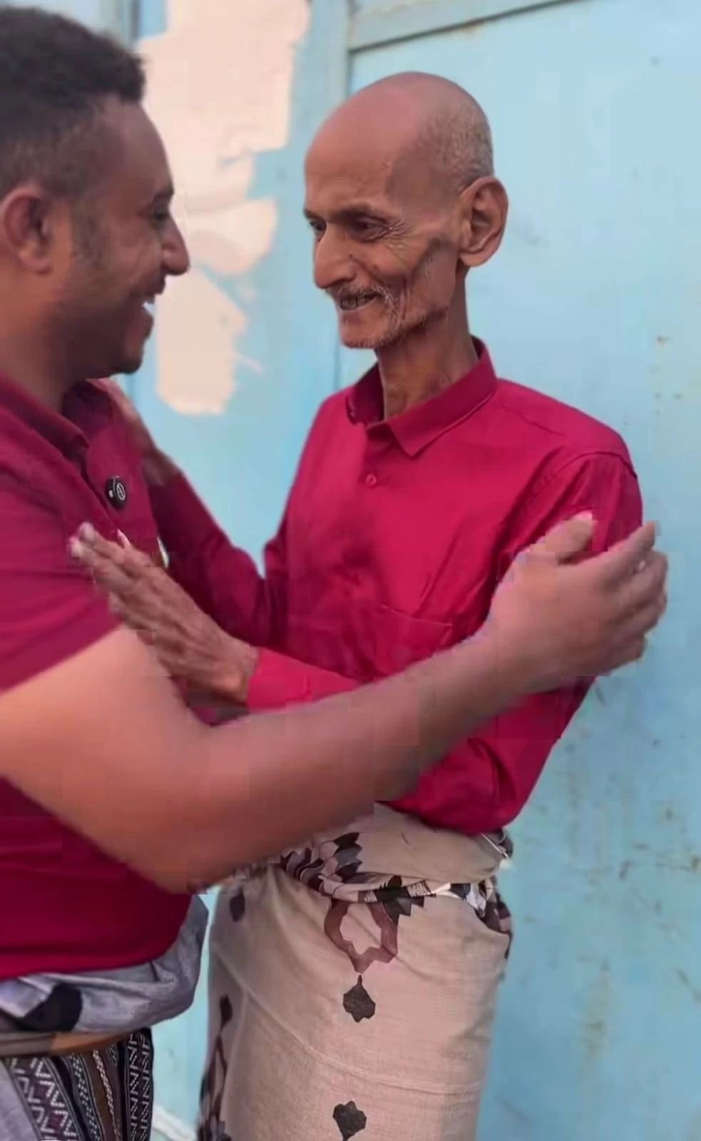 طبيب مصري «جائع ومشرد» يثير تعاطف اليمنيين.. وناشط: «سنُعيده معززًا مكرمًا» (فيديو)